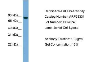 WB Suggested Anti-EXOC8  Antibody Titration: 0. (EXOC8 antibody  (N-Term))