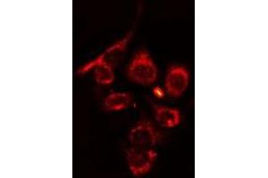 ABIN6275689 staining HT29 cells by IF/ICC. (ZFYVE19 antibody  (Internal Region))