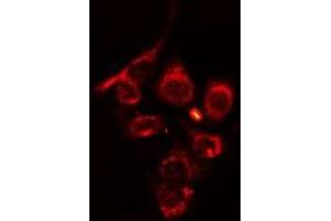 ABIN6275689 staining HT29 cells by IF/ICC. (ZFYVE19 antibody  (Internal Region))