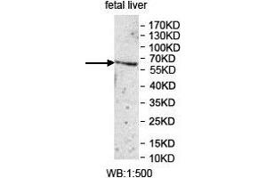 Western blot analysis of fetal liver lysate, using UGT1A1 antibody. (UGT1A1 antibody  (AA 26-193))