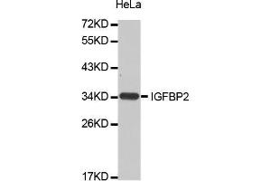 Western Blotting (WB) image for anti-Insulin-Like Growth Factor Binding Protein 2, 36kDa (IGFBP2) (AA 100-200) antibody (ABIN5663646) (IGFBP2 antibody  (AA 100-200))