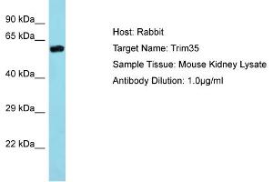 Host: Rabbit Target Name: Trim35 Sample Type: Mouse Kidney lysates Antibody Dilution: 1. (TRIM35 antibody  (Middle Region))
