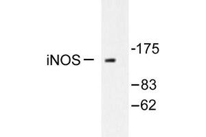 Image no. 1 for anti-Nitric Oxide Synthase 2, Inducible (NOS2) antibody (ABIN265479) (NOS2 antibody)