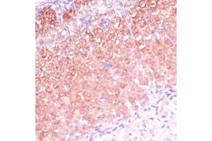 Immunohistochemistry of paraffin-embedded mouse adrenal gland using CYP11B2 antibody (ABIN1679468, ABIN3015492, ABIN3015493 and ABIN6218533) at dilution of 1:100 (40x lens). (CYP11B2 antibody  (AA 234-503))