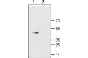 Western blot analysis of rat heart membranes:1.