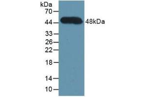Detection of Recombinant CFH, Human using Polyclonal Antibody to Complement Factor H (CFH) (Complement Factor H antibody  (AA 860-1231))