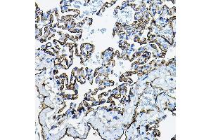 Immunohistochemistry of paraffin-embedded rat lung using  Rabbit pAb (ABIN3016739, ABIN3016740, ABIN3016741, ABIN1678526 and ABIN6219830) at dilution of 1:100 (40x lens). (Angiotensin I Converting Enzyme 1 antibody  (AA 30-270))