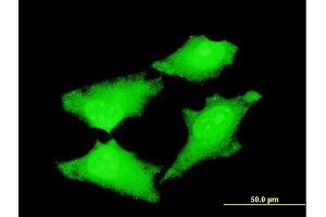 Immunofluorescence of monoclonal antibody to CDC45L on HeLa cell. (CDC45 antibody  (AA 1-566))