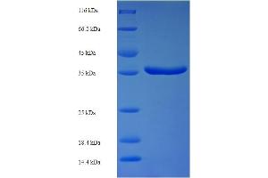 PPM1B Protein (AA 2-193) (His-SUMO Tag)