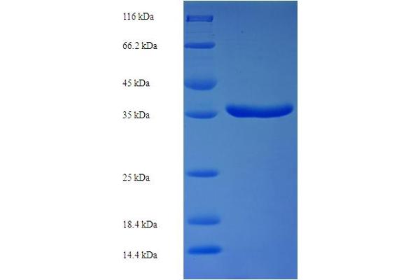 PPM1B Protein (AA 2-193) (His-SUMO Tag)