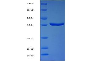 SDS-PAGE (SDS) image for Protein Phosphatase, Mg2+/Mn2+ Dependent, 1B (PPM1B) (AA 2-193) protein (His-SUMO Tag) (ABIN4975599)
