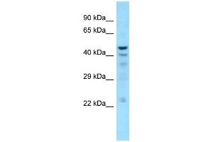 WB Suggested Anti-NT5C Antibody Titration: 1. (NT5C antibody  (C-Term))