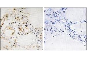 Immunohistochemistry analysis of paraffin-embedded human thyroid gland, using BCL-2 (Phospho-Ser87) Antibody. (Bcl-2 antibody  (pSer87))