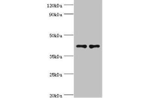 Western blot All lanes: CD33 antibody at 8 μg/mL Lane 1: K562 whole cell lysate Lane 2: HepG2 whole cell lysate Secondary Goat polyclonal to rabbit IgG at 1/10000 dilution Predicted band size: 40, 34, 26 kDa Observed band size: 40 kDa (CD33 antibody  (AA 49-259))