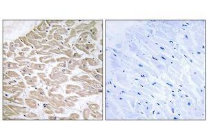 Immunohistochemistry analysis of paraffin-embedded human heart tissue using RAD antibody. (RRAD antibody  (Internal Region))