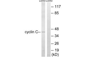 Western blot analysis of extracts from LOVO cells, using Cyclin C (epitope around residue 275) antibody. (Cyclin C antibody  (Ser275))