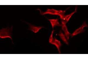 ABIN6275588 staining Hela by IF/ICC. (SLC24A3 antibody  (Internal Region))