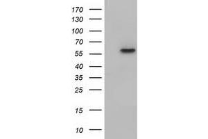 HEK293T cells were transfected with the pCMV6-ENTRY control (Left lane) or pCMV6-ENTRY KLHL2 (Right lane) cDNA for 48 hrs and lysed. (KLHL2 antibody  (AA 1-100, AA 494-593))