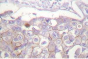 Image no. 1 for anti-Claudin 4 (CLDN4) antibody (ABIN265363) (Claudin 4 antibody)