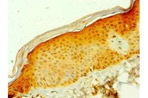 Immunohistochemistry of paraffin-embedded human skin tissue using ABIN7158940 at dilution of 1:100 (MDH1 antibody  (AA 1-334))