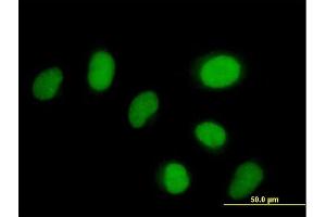 Immunofluorescence of purified MaxPab antibody to ZNF792 on HeLa cell. (ZNF792 antibody  (AA 1-553))