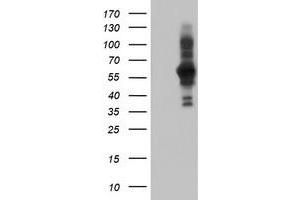 Western Blotting (WB) image for anti-PDZ and LIM Domain 5 (PDLIM5) antibody (ABIN1500132)