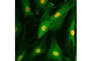 Human fibroblast-like synoviocytes were stained with anti-RelA followed by Goat Anti-Rabbit IgG(H+L), Mouse/Human ads-FITC and DAPI. (Goat anti-Rabbit IgG (Heavy & Light Chain) Antibody (FITC))