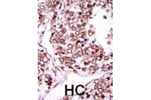 Immunohistochemistry (IHC) image for anti-Calcium/calmodulin-Dependent Protein Kinase II gamma (CAMK2G) antibody (ABIN2995254) (CAMKII gamma antibody)
