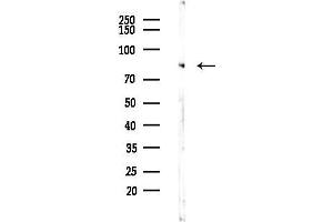 anti-Protein Kinase C, zeta (PRKCZ) (C-Term) antibody