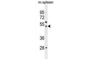 Western Blotting (WB) image for anti-Solute Carrier Family 16, Member 13 (Monocarboxylic Acid Transporter 13) (SLC16A13) antibody (ABIN2996178)