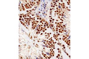 Immunohistochemistry (Paraffin-embedded Sections) (IHC (p)) image for anti-Ring-Box 1, E3 Ubiquitin Protein Ligase (RBX1) (AA 74-108), (C-Term) antibody (ABIN1944784)