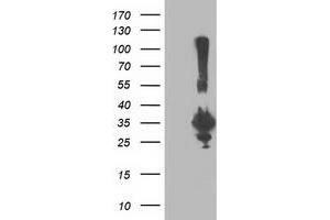 Western Blotting (WB) image for anti-Phenylethanolamine N-Methyltransferase (PNMT) antibody (ABIN1500311) (PNMT antibody)