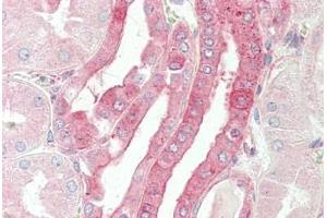 Human Kidney: Formalin-Fixed, Paraffin-Embedded (FFPE) (CELF3 antibody  (AA 3-32))