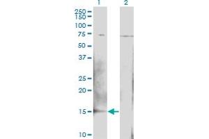 Western Blot analysis of BTG2 expression in transfected 293T cell line by BTG2 monoclonal antibody (M02), clone 1B8. (BTG2 antibody  (AA 59-158))