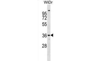 Western Blotting (WB) image for anti-Annexin A9 (ANXA9) antibody (ABIN2999180)