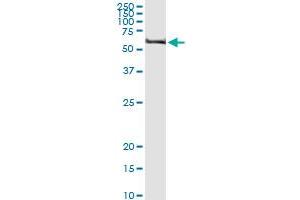 Immunoprecipitation of TRIM62 transfected lysate using anti-TRIM62 MaxPab rabbit polyclonal antibody and Protein A Magnetic Bead , and immunoblotted with TRIM62 purified MaxPab mouse polyclonal antibody (B01P) . (TRIM62 antibody  (AA 1-475))
