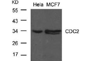Image no. 2 for anti-Cyclin-Dependent Kinase 1 (CDK1) (Tyr15) antibody (ABIN197482) (CDK1 antibody  (Tyr15))