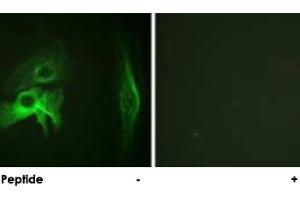 Immunofluorescence analysis of HeLa cells, using PAK1 polyclonal antibody .