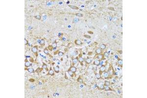 Immunohistochemistry (Paraffin-embedded Sections) (IHC (p)) image for anti-Actin-Related Protein 2 (ACTR2) (AA 1-160) antibody (ABIN6136493)