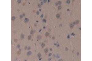 Used in DAB staining on fromalin fixed paraffin- embedded Kidney tissue (NOV antibody  (AA 150-354))