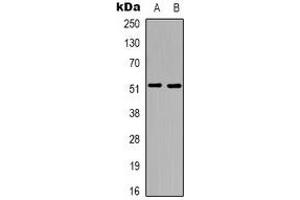 Western blot analysis of Tachykinin Receptor 3 expression in A549 (A), COLO205 (B) whole cell lysates. (TACR3 antibody  (C-Term))