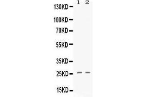 Western blot analysis of PF4 expression in 293T whole cell lysates ( Lane 1) and A549 whole cell lysates ( Lane 2). (PF4 antibody  (AA 32-101))