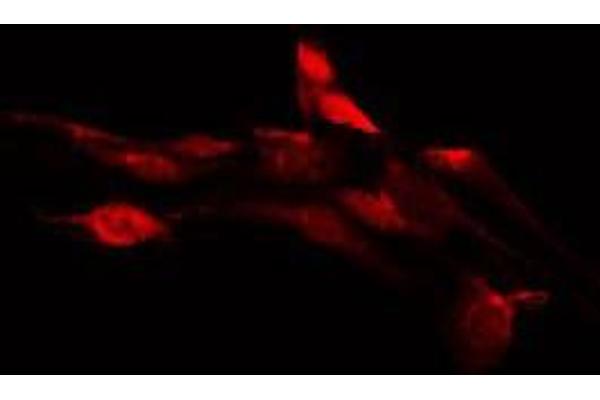 OR1D2 antibody  (Internal Region)