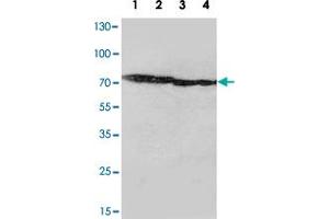 Western blot analysis of tissue lysates with MAPT polyclonal antibody . (MAPT antibody  (N-Term))