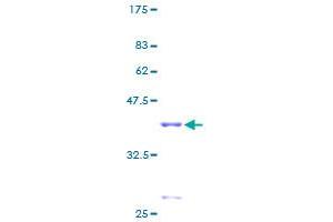 SPEG Protein (AA 1-113) (GST tag)