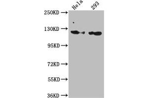 Western Blot Positive WB detected in: Hela whole cell lysate, 293 whole cell lysate All lanes: RNF20 antibody at 1:1000 Secondary Goat polyclonal to rabbit IgG at 1/50000 dilution Predicted band size: 114 kDa Observed band size: 114 kDa (Recombinant RNF2 antibody)