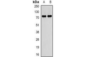 Western blot analysis of PADI4 expression in BT474 (A), SKOV3 (B) whole cell lysates. (PAD4 antibody)