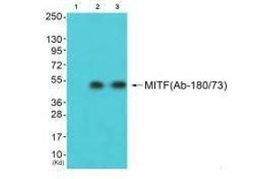 Western blot analysis of extracts from HepG2 cells (Lane 2) and 3T3 cells (Lane 3), using MITF (Ab-180/73) antiobdy. (MITF antibody  (Ser73, Ser180))