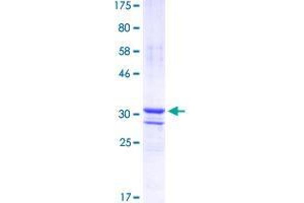 SP7 Protein (AA 87-162) (GST tag)