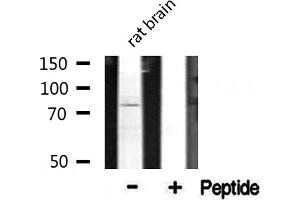 Western blot analysis of extracts from rat Brian, using CDH9 antibody. (Cadherin 9 antibody  (Internal Region))